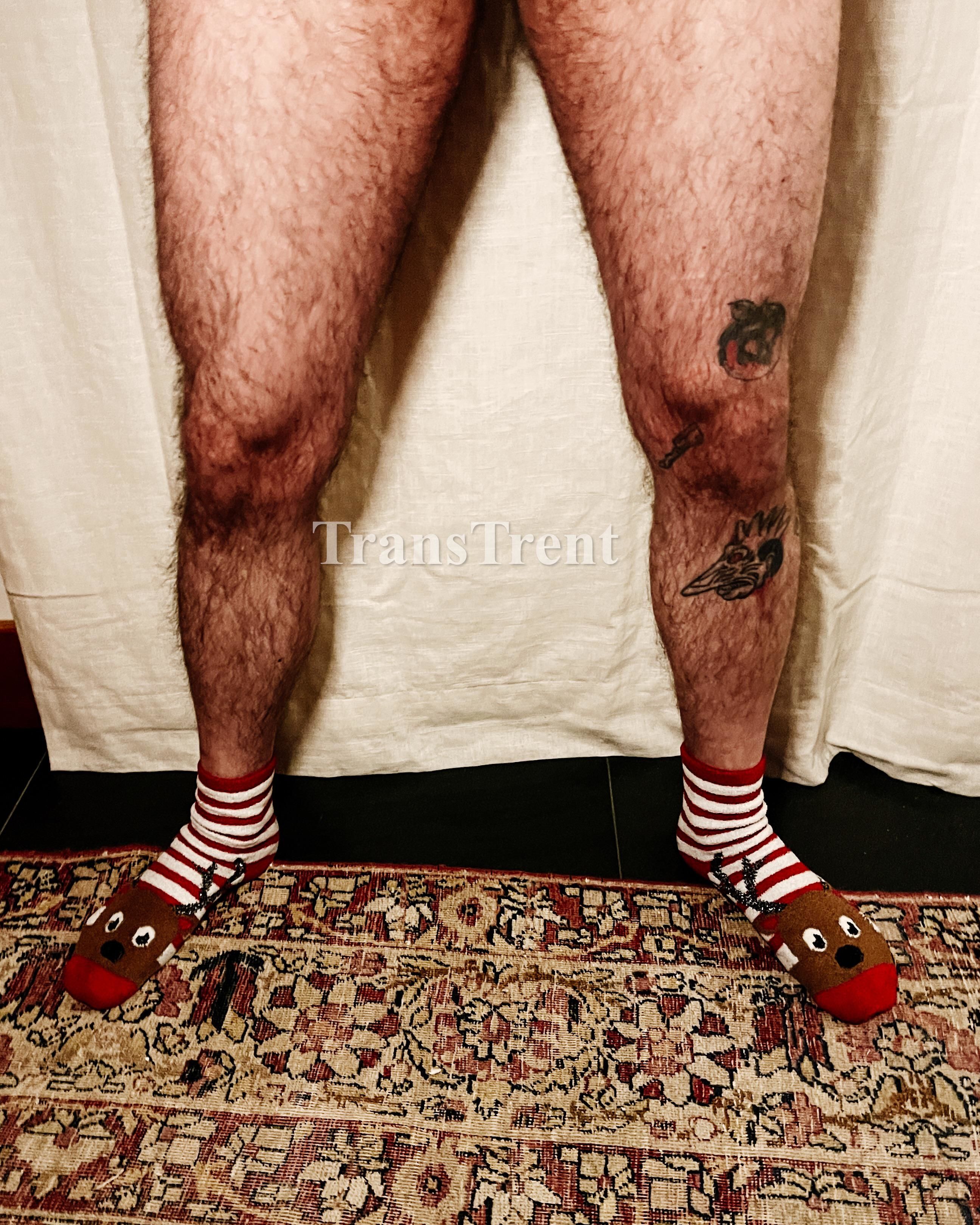 Hairy Legs Boys
